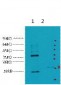 CA IX Monoclonal Antibody(12F10)